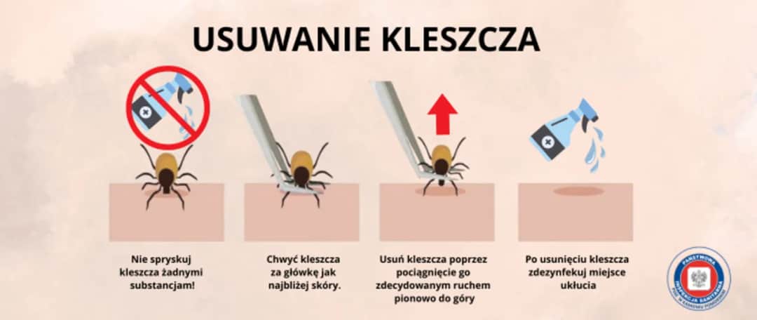 Jak wyjąć kleszcza? Bezpieczny sposób krok po kroku
