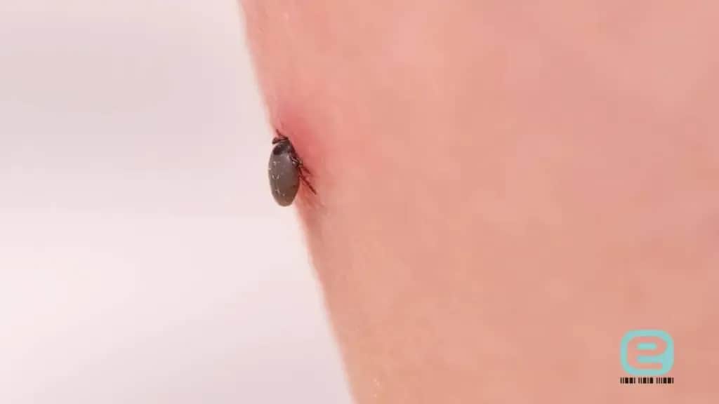 Jak rozpoznać kleszcza? Wygląd, stadia i ugryzienie