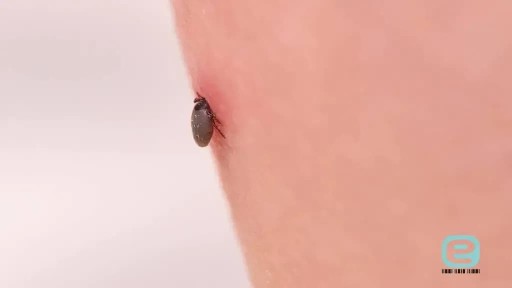 Jak rozpoznać kleszcza? Wygląd, stadia i ugryzienie