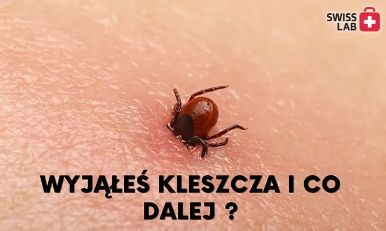 Jak sprawdzić, czy kleszcz wyszedł cały? Praktyczny poradnik